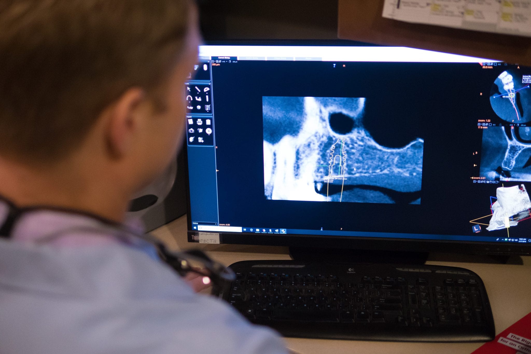 Dental Imaging Mace Dental Group Washington, MO 63090