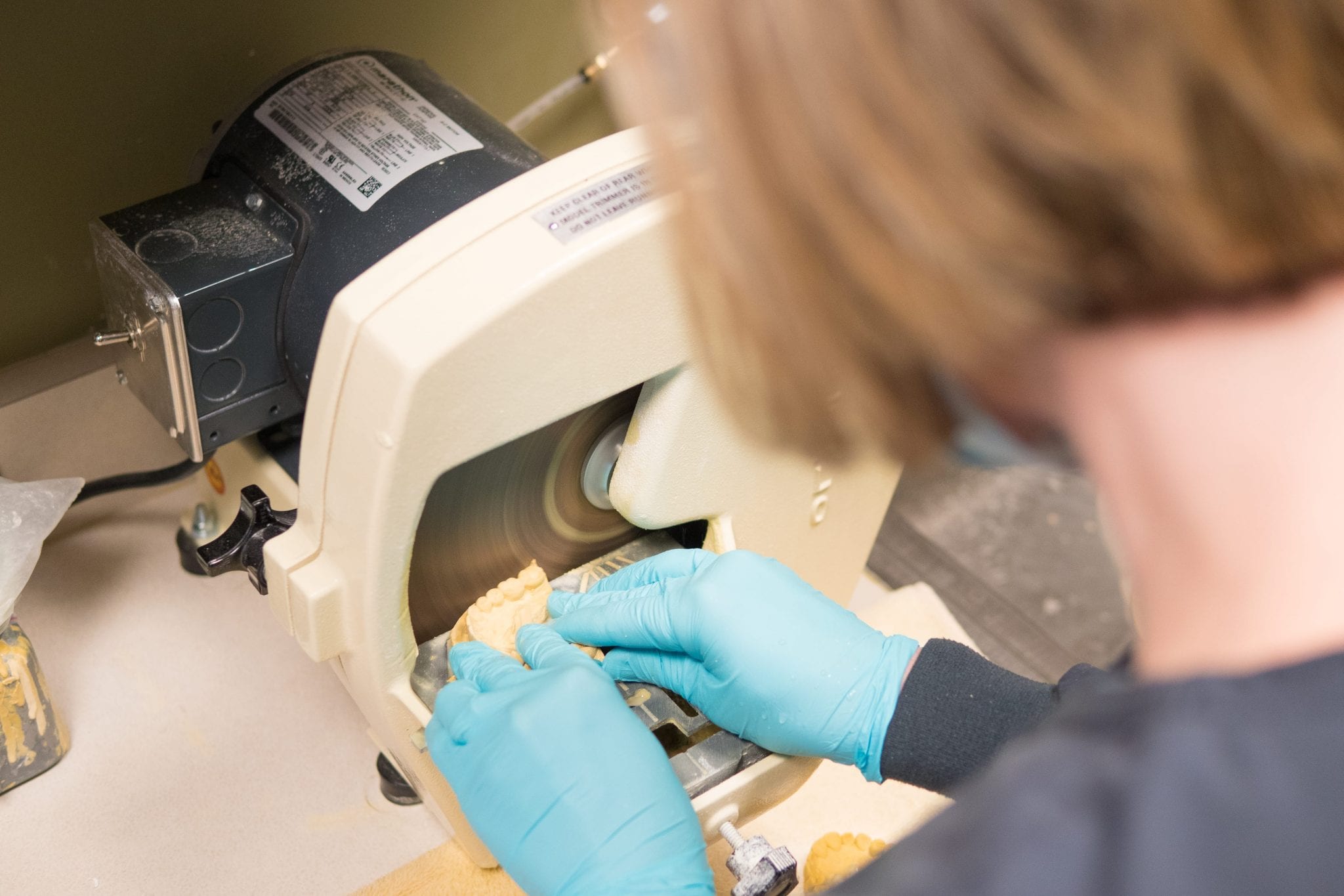 Restorative Dentistry Mace Dental Group Washington, MO 63090