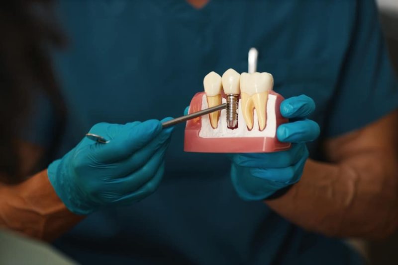 Dental Implants Washington, MO